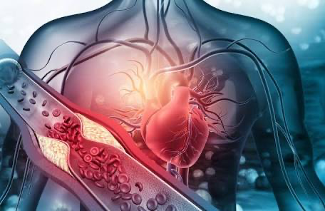 Comment la Médecine de Précision Redessine la Cardiologie Moderne